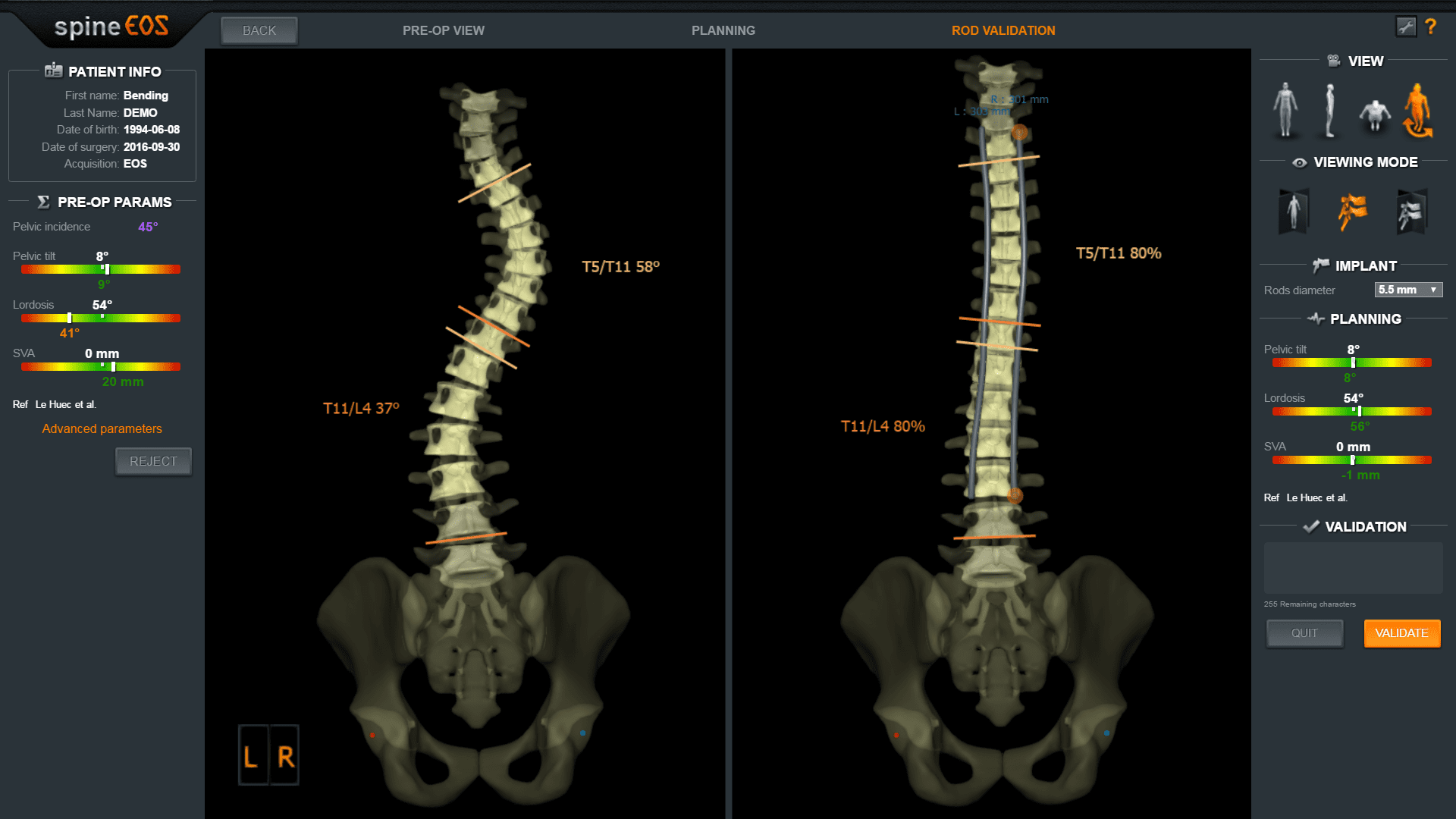 spineEOS AIS Interface